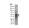 Western blot testing of human MCF7 cell lysate with recombinant GATA3 antibody (clone GATA3/4550R). Observed molecular weight: ~50 kDa (full length), ~37 kDa (splice form).