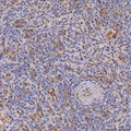 IHC staining of FFPE human spleen cancer tissue with IL2-inducible T-cell kinase antibody. HIER: boil tissue sections in pH8 EDTA for 20 min and allow to cool before testing.