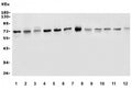 Western blot testing of 1) human HeLa, 2) human MCF7, 3) human A375, 4) human T-47D, 5) human A549, 6) monkey COS-7, 7) rat NRK, 8) rat RH-35, 9) mouse kidney, 10) mouse liver, 11) mouse RAW264.7 and 12) mouse HEPA1-6 cell lysate with P2X4 antibody. Expected molecular weight: 43-70 kDa depending on glycosylation level.