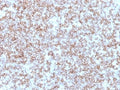 IHC: Formalin-fixed, paraffin-embedded human tonsil stained with HLA-DP / HLA-DR antibody (Bra-14).