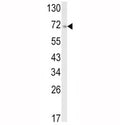 Western blot analysis of ATF6 antibody and A2058 lysate. Predicted molecular weight: 75~90kDa.