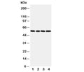Western blot testing of TXNRD2 antibody and rat samples 1: kidney; 2: ovary; 3: liver; 4: human SMMC-7721 cell lysate