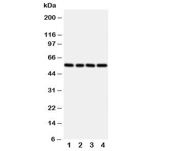 Western blot testing of TXNRD2 antibody and rat samples 1: kidney; 2: ovary; 3: liver; 4: human SMMC-7721 cell lysate