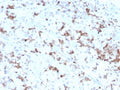 IHC testing of FFPE human pituitary tissue with Prolactin antibody (clone PRL/2641). Required HIER: boil tissue sections in pH6, 10mM citrate buffer, for 10-20 min followed by cooling at RT for 20 min.