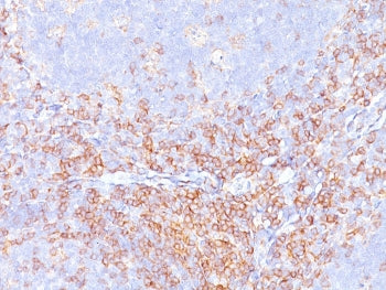 IHC staining of FFPE human tonsil with recombinant CD4 antibody. HIER: boil tissue sections in pH 9 10mM Tris with 1mM EDTA for 20 min and allow to cool before testing.