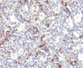 IHC testing of FFPE human spleen and HNK-1 antibody (clone CDLA57).
