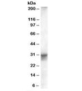 Western blot testing of human heart lysate with FHL1 antibody at 0.01ug/ml. Predicted/observed molecular weight: ~36/30-36kDa.