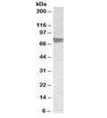 Western blot testing of human skeletal muscle lysate with TRC8 antibody at 1ug/ml. Predicted/observed molecular weight: ~75kDa.