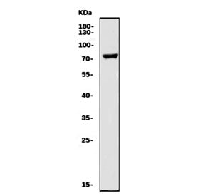 Western blot testing of human HeLa cell lysate with LHCGR antibody. Expected molecular weight: 38-60 kDa but may be observed at higher molecular weights due to glycosylation.