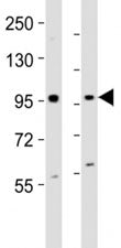 Western blot testing of EZH2 antibody at 1:2000 dilution. Lane 1: mouse F9 lysate; 2: human K562 lysate; Predicted band size : 95 kDa.