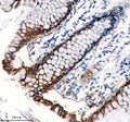 Immunohistochemical staining of TNS4 using anti-TNS4 antibody. TNS4 was detected in a paraffin-embedded section of human placenta tissue. Heat mediated antigen retrieval was performed in EDTA buffer (pH 8.0, epitope retrieval solution). The tissue section was blocked with 10% goat serum. The tissue section was then incubated with 2 ug/ml rabbit anti-TNS4 antibody overnight at 4oC. Peroxidase Conjugated Goat Anti-rabbit IgG was used as secondary antibody and incubated for 30 min at 37oC.