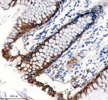 Immunohistochemical staining of TNS4 using anti-TNS4 antibody. TNS4 was detected in a paraffin-embedded section of human placenta tissue. Heat mediated antigen retrieval was performed in EDTA buffer (pH 8.0, epitope retrieval solution). The tissue section was blocked with 10% goat serum. The tissue section was then incubated with 2 ug/ml rabbit anti-TNS4 antibody overnight at 4oC. Peroxidase Conjugated Goat Anti-rabbit IgG was used as secondary antibody and incubated for 30 min at 37oC.