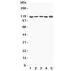 Western blot testing of C5A antibody and Lane 1: rat liver; 2: mouse liver; 3: (m) NIH3T3; 4: (m) HEPA1-6; 5: (r) PC12 lysate; Predicted molecular weight ~115 kDa.