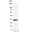 Western blot testing of TIMP1 antibody and Lane 1: recombinant human protein 10ng; 2: 5ng; 3. 2.5ng