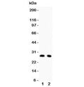 Western blot testing of p27KIP1 antibody and Lane 1: rat thymus; 2: rat brain lysate. Expected/observed molecular weight ~27 kDa.