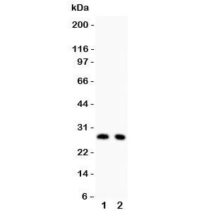 Western blot testing of p27KIP1 antibody and Lane 1: rat thymus; 2: rat brain lysate. Expected/observed molecular weight ~27 kDa.