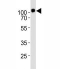 Western blot analysis of lysate from KG-1 cell line using CD34 antibody diluted at 1:1000. Expected size is 40~110 kDa depending on glycosylation level.