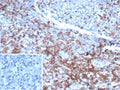 IHC staining of FFPE human lymph node tissue with CD3e antibody (clone rC3e/6967). Inset: PBS used in place of primary Ab (secondary Ab negative control). HIER: boil tissue sections in pH 9 10mM Tris with 1mM EDTA for 20 min and allow to cool before testing.
