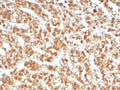 IHC staining of FFPE human adrenal gland tissue with Interleukin-1 beta antibody (clone IL1B/4651). HIER: boil tissue sections in pH 9 10mM Tris with 1mM EDTA for 20 min and allow to cool before testing.