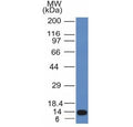 Western blot analysis of a recombinant protein fragment of ALK using Anaplastic Lymphoma Kinase antibody (clone ALK/1031).