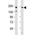 Western blot testing of Erbb2 antibody at 1:2000 dilution. Lane 1: mouse ovary lysate; 2: rat lung lysate; Predicted band size : 139 kDa.