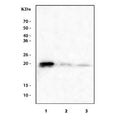 Western blot testing of 1) human A431, 2) rat PC-12 and 3) mouse brain tissue lysate with CIB1 antibody. Predicted molecular weight ~21 kDa.