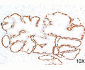 IHC testing of human prostate (10X) stained with Cytokeratin 14 antibody (LL002).