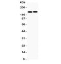 Western blot testing of CD45 antibody and Lane 1: Jurkat; 2: Raji lysate. Expected molecular weight: ~147/180-220 kDa (unmodified/glycosylated).