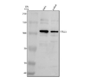 Western blot analysis of TTLL5 using anti-TTLL5 antibody. Electrophoresis was performed on a 8% SDS-PAGE gel at 80V (Stacking gel) / 120V (Resolving gel) for 2 hours. Lane 1: human Hela whole cell lysates, Lane 2: human Jurkat whole cell lysates. After electrophoresis, proteins were transferred to a nitrocellulose membrane at 150 mA for 50-90 min. Blocked the membrane with 5% non-fat milk/TBS for 1.5 hour at RT.