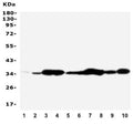 Western blot testing of Annexin V antibody and Lane 1: rat brain; 2: rat skeletal muscle; 3: rat ovary; 4: rat lung; 5: MCF-7; 6: SMMC-7721; 7: A549; 8: Jurkat; 9: SGC; 10: HT1080; Predicted molecular weight ~36 kDa.