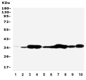 Western blot testing of Annexin V antibody and Lane 1: rat brain; 2: rat skeletal muscle; 3: rat ovary; 4: rat lung; 5: MCF-7; 6: SMMC-7721; 7: A549; 8: Jurkat; 9: SGC; 10: HT1080; Predicted molecular weight ~36 kDa.