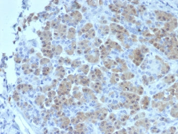 IHC staining of FFPE human salivary gland tissue with BRCA2 antibody (clone BRCA2/2158). HIER: boil tissue sections in pH 9 10mM Tris with 1mM EDTA for 20 min and allow to cool before testing.