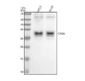 Western blot analysis of C1QA using anti-C1QA antibody. Electrophoresis was performed on a 12% SDS-PAGE gel at 80V (Stacking gel) / 120V (Resolving gel) for 2 hours. Lane 1: human HCCT whole cell lysates, Lane 2: human HCCP whole cell lysates. After electrophoresis, proteins were transferred to a nitrocellulose membrane at 150 mA for 50-90 min. Blocked the membrane with 5% non-fat milk/TBS for 1.5 hour at RT.