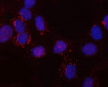 Immunofluorescent staining of FFPE human U-2 OS cells with SNX6 antibody (red) and DAPI nuclear stain (blue). HIER: steam section in pH6 citrate buffer for 20 min.