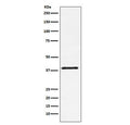 Western blot testing of mouse NIH3T3 cell lysate with CD152 antibody. Predicted molecular weight ~25 kDa but may be observed at higher molecular weights due to glycosylation.