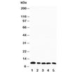 Western blot testing of MIP-1 beta antibody and mouse samples: 1. spleen, 2. heart, 3. lung, 4. kidney, 5. skeletal muscle tissue lysate. Expected molecular weight: 10/8kDa (precusor/mature).