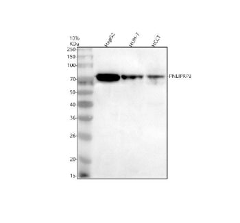 Western blot analysis of PNLIPRP3 using anti-PNLIPRP3 antibody. Electrophoresis was performed on a 10% SDS-PAGE gel at 80V (Stacking gel) / 120V (Resolving gel) for 2 hours. Lane 1: human HepG2 whole cell lysates, Lane 2: human HUH-7 whole cell lysates, Lane 3: human HCCT whole cell lysates. After electrophoresis, proteins were transferred to a nitrocellulose membrane at 150 mA for 50-90 min. Blocked the membrane with 5% non-fat milk/TBS for 1.5 hour at RT.
