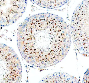 Immunohistochemical staining of TESMIN using anti-TESMIN antibody. TESMIN was detected in a paraffin-embedded section of rat testis tissue. Heat mediated antigen retrieval was performed in EDTA buffer (pH 8.0, epitope retrieval solution). The tissue section was blocked with 10% goat serum. The tissue section was then incubated with 2 ug/ml rabbit anti-TESMIN antibody overnight at 4oC. Peroxidase Conjugated Goat Anti-rabbit IgG was used as secondary antibody and incubated for 30 min at 37oC.