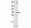 Western blot analysis of SNAI1 antibody and 293 cell lysate (2 ug/lane) either nontransfected (Lane 1) or transiently transfected with the SNAIL gene (2). Predicted molecular weigth ~29kDa.