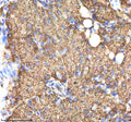 IHC staining of zebrafish Ndr1 protein using Zebrafish Ndr1 antibody, HRP-labeled secondary and DAB substrate. Ndr1 was detected in a paraffin-embedded section of zebrafish pancreas tissue. HIER: boil tissue sections in pH8 EDTA for 20 min and allow to cool before testing.