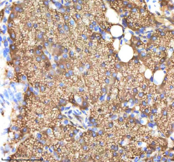 IHC staining of zebrafish Ndr1 protein using Zebrafish Ndr1 antibody, HRP-labeled secondary and DAB substrate. Ndr1 was detected in a paraffin-embedded section of zebrafish pancreas tissue. HIER: boil tissue sections in pH8 EDTA for 20 min and allow to cool before testing.