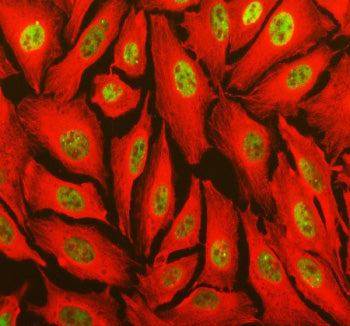 Immunofluorescent staining of TOPBP1 using anti-TOPBP1 antibody (green) and anti-Beta Tubulin antibody (red). TOPBP1 was detected in an immunocytochemical section of U2OS cells. Enzyme antigen retrieval was performed using IHC enzyme antigen retrieval reagent for 15 mins. The cells were blocked with 10% goat serum. And then incubated with 5 ug/ml rabbit anti-TOPBP1 antibody and mouse anti-Beta Tubulin antibody overnight at 4oC. DyLight 488 Conjugated Goat Anti-Rabbit IgG and Cy3 Conjugated Goat Anti-Mouse I