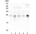 Western blot testing of human 1) placenta, 2) HepG2, 3) T-47D, 4) HeLa and 5) monkey COS-7 lysate with RHOB antibody at 0.5ug/ml. Predicted molecular weight ~22 kDa.