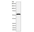 Western blot testing of human Jurkat cell lysate with Membrane Palmitoylated Protein 1 antibody. Expected molecular weight 52-55 kDa.