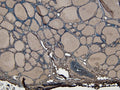 IHC staining of FFPE human thyroid gland tissue with ENPP1 antibody at 4ug/ml. HIER: steamed with pH6 citrate buffer, HRP-staining.