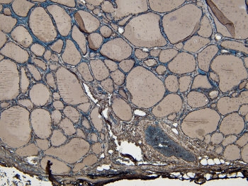 IHC staining of FFPE human thyroid gland tissue with ENPP1 antibody at 4ug/ml. HIER: steamed with pH6 citrate buffer, HRP-staining.