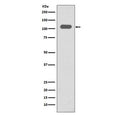 Western blot testing of human spleen lysate with ITGB3 antibody. Expected molecular weight: 87-110 kDa depending on glycosylation level.