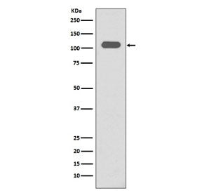 Western blot testing of human spleen lysate with ITGB3 antibody. Expected molecular weight: 87-110 kDa depending on glycosylation level.