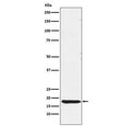 Western blot testing of human pituitary lysate with TSH beta antibody. Predicted molecular weight ~16 kDa.