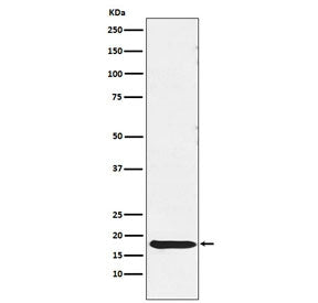 Western blot testing of human pituitary lysate with TSH beta antibody. Predicted molecular weight ~16 kDa.